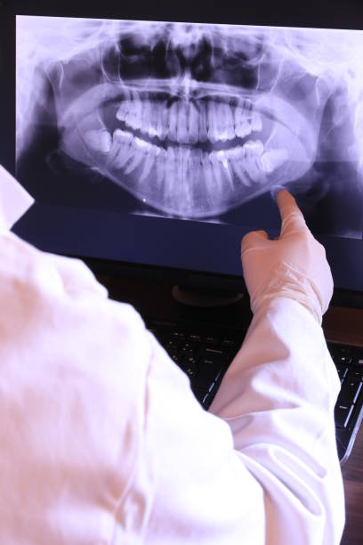 Emergency Dental Filling Replacement in SC