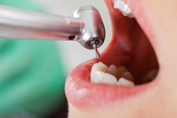 Dentist for Dental Trauma in SC
